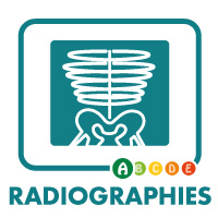 Pictogramme Radiographies